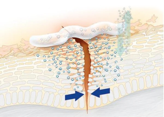 Graphic illustrating the breathable barrier of Aquaphor